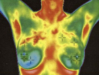 Thermalogica Health Screening with Thermal Full Body Scans in Bath, Exeter, London or Your Office.
